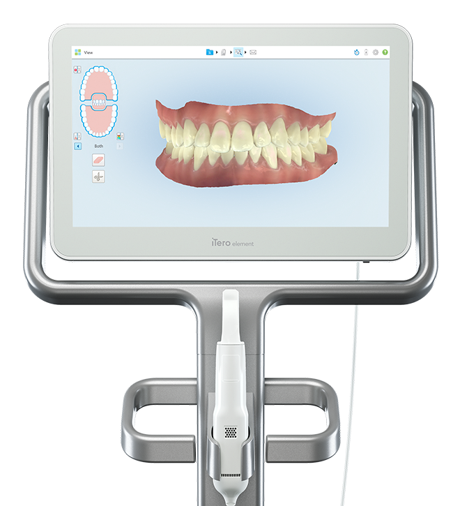 iTero element 2 digital scanner